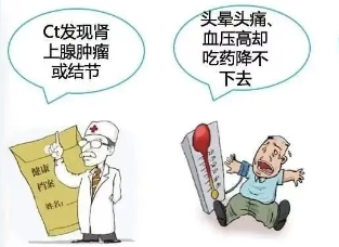優(yōu)勢學(xué)科 | 泌尿外科 “后腹腔鏡下右腎上腺腫瘤切除術(shù)”為患者精準(zhǔn)“拆彈”